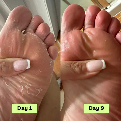 NEGUSY™ Tea Tree Athlete's Foot Defense Soap